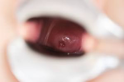 503 - As Wide as it Gets